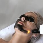 HOLLYWOOD PEEL