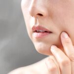 RELLENO DE SURCOS NASOGENIANOS Y/O MARIONETA CON JUVÉDERM® – REJUVENECIMIENTO SIN CIRUGÍA