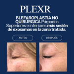 PLEXR