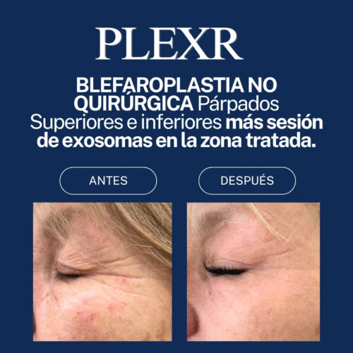 PLEXR