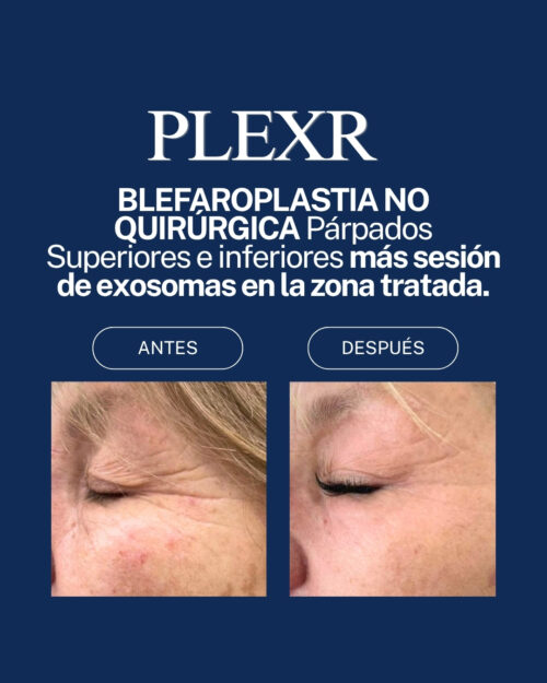 PLEXR