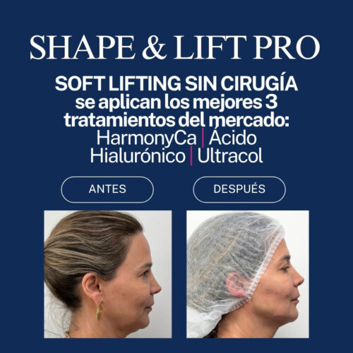 Shape & lift pro OZ CLINIC