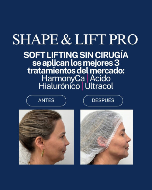 Shape & lift pro OZ CLINIC